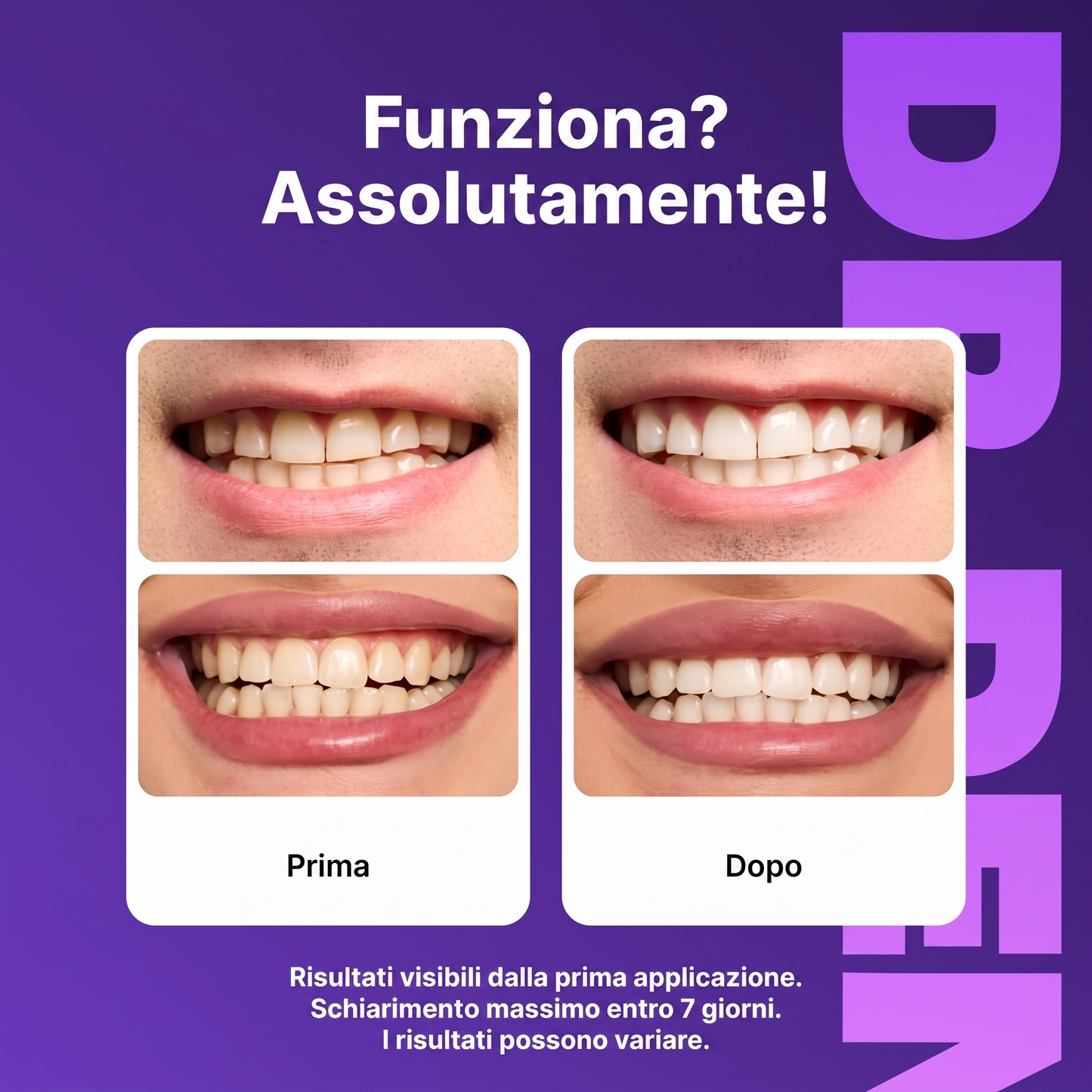 halarva™ Strisce Sbiancanti Denti